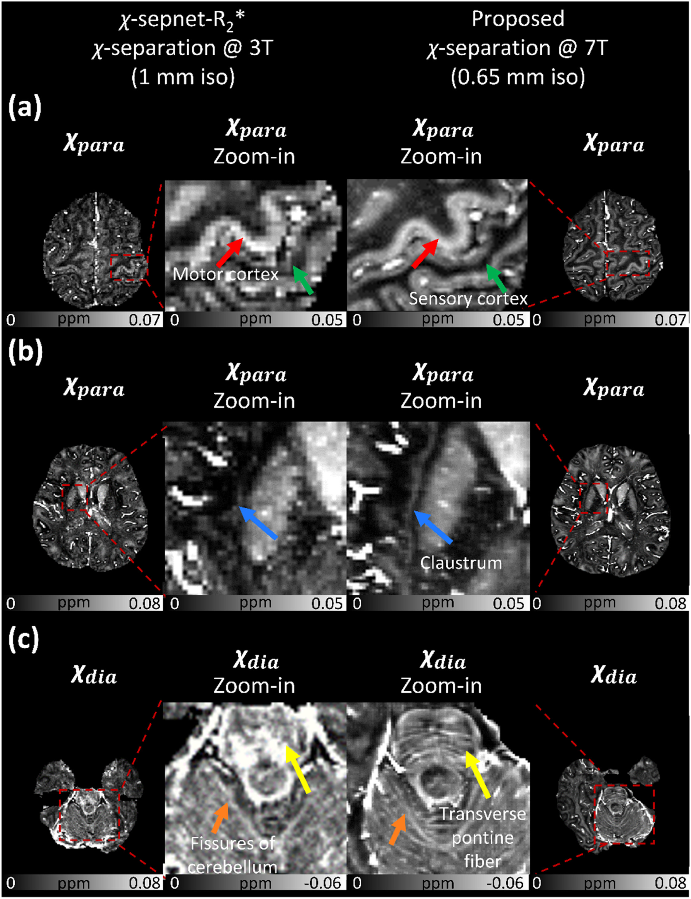 Representative figure for In-vivo high-resolution χ-separation at 7T